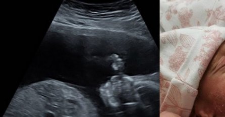 "Već na ultrazvuku se naziralo nešto čudno, a onda je na porođaju babica odmah uzela telefon da ih slika": OVO JOŠ NISU VIDJELI