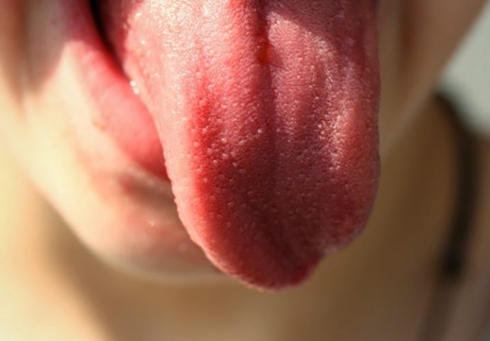 Britanski naučnik upozorio na sve češći simptom – “covid jezik”