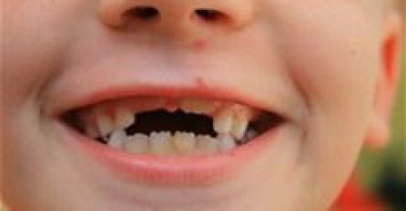 SANJATE DA VAM ISPADAJU ZUBI? To je LOŠ ZNAK, evo šta vas čeka! 