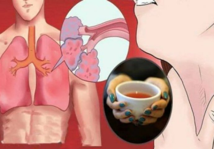 Čaj koji sprječava kašalj i liječi izmučena pluća 