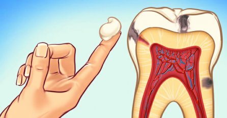 Može i bez ZUBARA: Donosimo vam prirodni lijek koji BRIŠE ZUBOBOLJU u samo nekoliko minuta