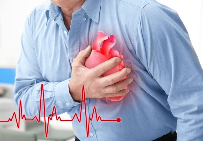 LJEKARI SAVJETUJU: Ovih dana povećana je opasnost od moždanog i srčanog udara, evo šta treba učiniti