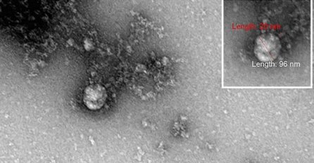 Ovako izgleda novi soj koronavirusa: Objavljena prva fotografija