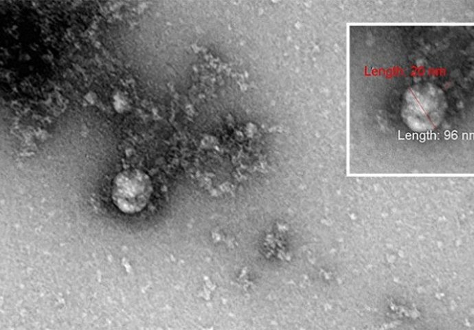 Ovako izgleda novi soj koronavirusa: Objavljena prva fotografija