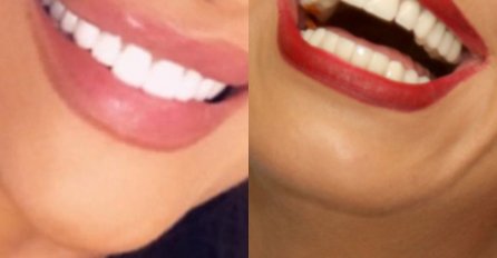 MOŽETE LI PREPOZNATI DOMAĆE PJEVAČICE SAMO NA OSNOVU NJIHOVOG OSMIJEHA? 1 možda i prepoznate, ALI KO JE NA BROJU 2 - NEMA ŠANSE 