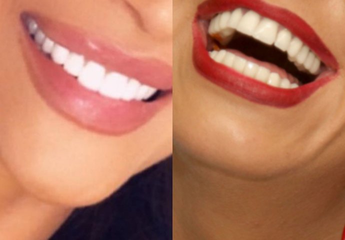 MOŽETE LI PREPOZNATI DOMAĆE PJEVAČICE SAMO NA OSNOVU NJIHOVOG OSMIJEHA? 1 možda i prepoznate, ALI KO JE NA BROJU 2 - NEMA ŠANSE 