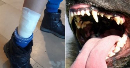 Oglasio se očajni OTAC djevojčice koju je izgrizao pas u Doglodima: Moje dijete je hitno operisano