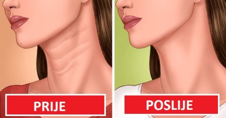 MUČE LI VAS DOSADNE LINIJE NA VRATU?  6 trikova KOJI ĆE VAM POMOĆI da ih se ZAUVIJEK RIJEŠITE