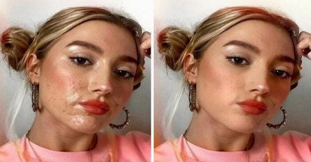 DJEVOJKE POKAZALE PRAVO LICE BEZ FILTERA: Dokaz koliko je Instagram ustvari lažan (FOTO)