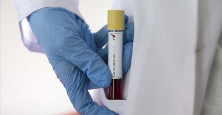 U  RS-u posljednja24 sata pet osoba preminulo od posljedica koronavirusa