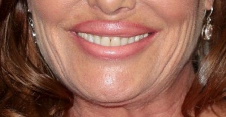 "Kakav je ovo UŽAS NA LICU?", niko ne može da je prepozna: Bila je najljepša, a danas živi u brdima da je niko ne može vidjeti (FOTO)