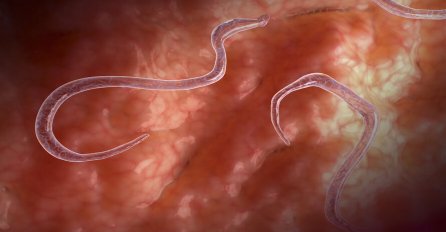 AKO OSJEĆATE OVE SIMPTOME, VAŠA CRIJEVA PUNA SU PARAZITA: Možete ih ukloniti JAKO BRZO sa ovom namirnicom 