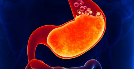 Ovo su PRVI SIMPTOMI raka želuca i mogu vam spasiti život: Oboljeli obično prijavljuju ovih 7 SIMPTOMA