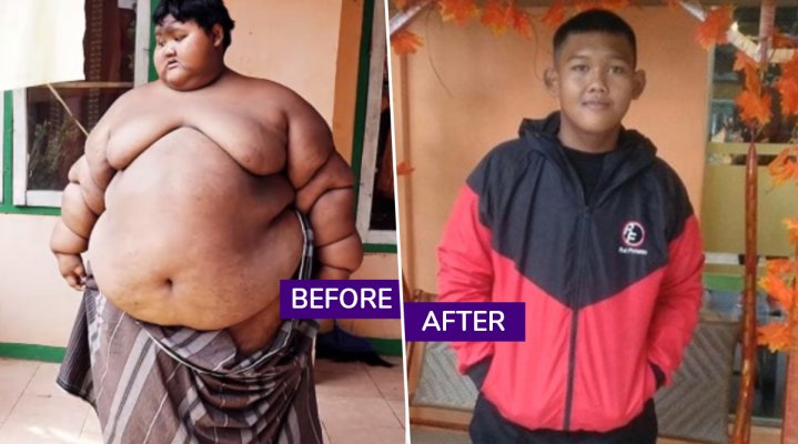 indonesias-fattest-teenager-arya-permana-weight-loss-transformation