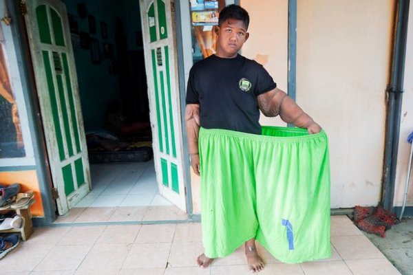 0-worlds-heaviest-kid-loses-220lbs