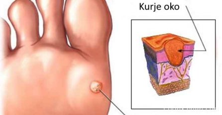 STAVITE LIST OVE BILJKE NA KURJE OKO I ONO ĆE NESTATI PREKO NOĆI: Ko je god probao nije se pokajao