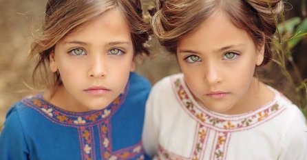 PRIJE 10 GODINA ROĐENE SU NAJLJEPŠE BLIZANKINJE NA SVIJETU: A evo kako danas izgledaju ove djevojčice, OBJAVLJENA NJIHOVA NAJNOVIJA SLIKA