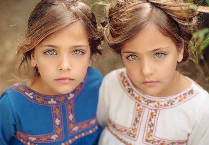 PRIJE 10 GODINA ROĐENE SU NAJLJEPŠE BLIZANKINJE NA SVIJETU: A evo kako danas izgledaju ove djevojčice, OBJAVLJENA NJIHOVA NAJNOVIJA SLIKA