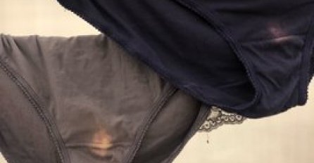 EVO ŠTA ZNAČI KADA VAM SE POJAVE BIJELE FLEKE NA GAĆICAMA: Žene, obratite pažnju! Ovo je pravi razlog