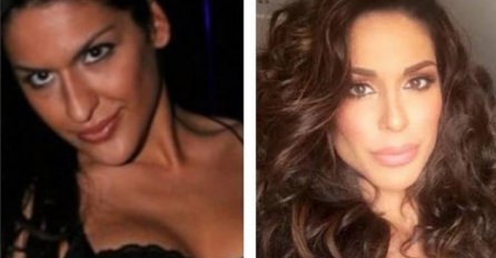 NIJE DOVOLJNO “IZOPERISANA”: Marina Visković ponovo ide pod nož! EVO ŠTA ŽELI PROMIJENITI!