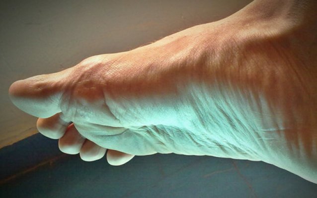 common-foot-problems-symptoms