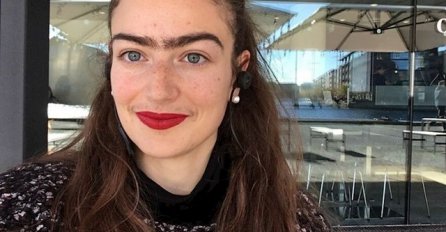 DJEVOJKA PRESTALA ČUPATI OBRVE I BRKOVE, NJENE FOTOGRAFIJE ZAPREPASTILE SU SVIJET, a ovako je izgledala prije “transformacije”