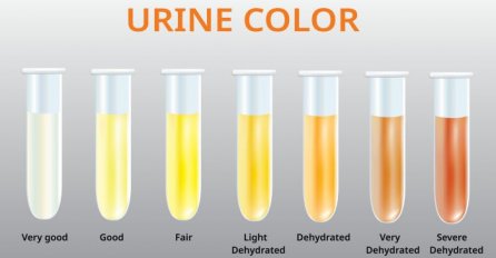 Evo šta BOJA URINA i pojava PENE govore o vašem ZDRAVLJU i kada je VRIJEME da se OBRATITE LJEKARU!