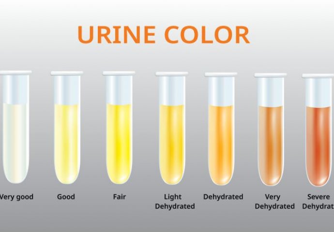 OVO JE JASAN ZNAK DA VAM BUBREZI OTKAZUJU: Pogledajte boju vašeg urina, UKOLIKO JE OVE BOJE  - ODMAH LJEKARU