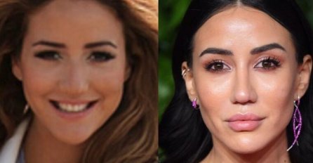 OVOME SE DIVITE, A SVE JE LAŽ I PREVARA - OVA SLIKA JE TEK POČETAK: Pogledajte PRAVO LICE dama sa estrade PRIJE FILERA, FOTOŠOPA I PLASTIČARA