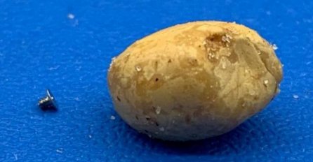 Na ovoj fotografiji svi vide KROMPIR - a kada pogledaju bolje, zinu od čuda, nije ni blizu! (FOTO)