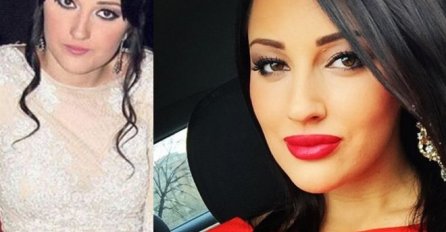 OVAKO JE ALEKSANDRA PRIJOVIĆ IZGLEDALA PRIJE OPERACIJA, IMA SAMO 25 GODINA A VEĆ NE LIČI NA SEBE: Ponovo ide kod plastičara?