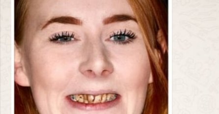 NAKON 3 GODINE OSVETILA BIVŠEM DEČKU: Kad je vidio sliku nakon ugradnje novih zuba, pojeo se od muke (FOTO)