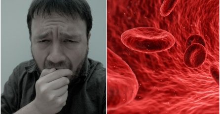 Znate li kako prepoznati KRVNE UGRUŠKE? Ove simptome shvatite JAKO OZBILJNO !