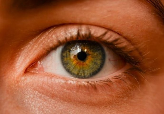 OVAJ SIMPTOM RAKA PLUĆA SE JAVLJA NA LICU, MNOGI MISLE DA JE BEZAZLENO: Pogledajte u oči, IZGLEDAJU LI OVAKO? ODMAH LJEKARU