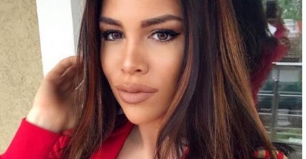 KAJA OSTOJIĆ POKAZALA LICE - UVEĆALA SVOJE PUNE USNE, PRIZOR JE ZASTRAŠUĆ: Evo kako sada izgleda, OBJAVLJENA NOVA SLIKA