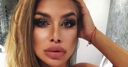 IVANA IZ HURRICANE PRAVA JE LJEPOTICA, A ČEKAJTE DA VIDITE SLIKE PRIJE OPERACIJA: Evo kako je izgledala, KAO DRUGA ŽENA