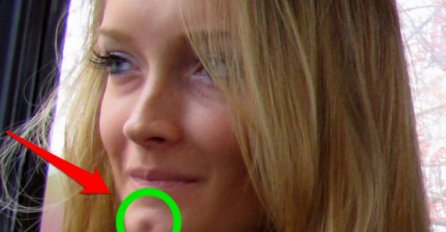 IMATE LI RUPICU NA BRADI?! EVO ŠTA TO GOVORI O VAMA: Nije slučajno, iznenadit ćete se kad čujete