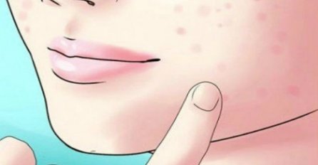 ŽENE, NIKAKO NE IGNORIŠITE, DLAKE NA BRADI SU ALARMANTAN ZNAK: Ukazuju na tešku bolest,  ODMAH KOD LJEKARA