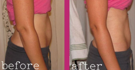 ŽENE POLUDILE ZA OVOM TEHNIKOM! Zavijala je svoj stomak u plastičnu foliju svake noći: EVO ŠTA JE POSTIGLA!