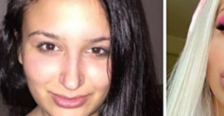 PRVU PLASTIČNU OPERACIJU JE URADILA SA 13 GODINA: Od tad je svaki mjesec uradila po jednu i niko ne vjeruje da SADA IZGLEDA OVAKO (FOTO) 