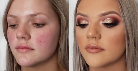 ČUDESNA MOĆ ŠMINKE: Djevojke odlučile pokazati svoje lice SA I BEZ ŠMINKE, OVO SU NEVJEROVATNE TRANSFORMACIJE