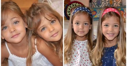Prije 11 godina proglašene su NAJLEPŠIM BLIZNAKINJAMA NA SVIJETU, a šokiraćete se kad ih SADA VIDITE: Evo kako danas izgledaju i zašto svi tvrde da ih majka uništava