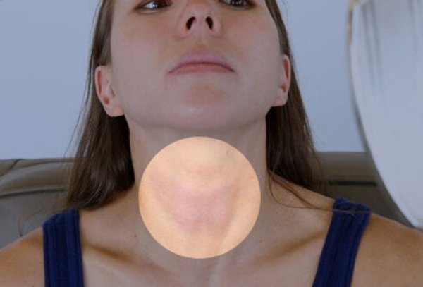 thyroid-symptoms-and-solutions-s13