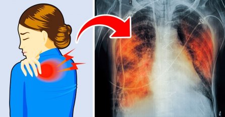 EVO KOJI SU RANI SIMPTOMI ZLOĆUDNOG RAKA, A SVI IH IGNORIŠU: Obratite pažnju na znakove koje vam tijelo šalje i SPASITE SEBI ŽIVOT!