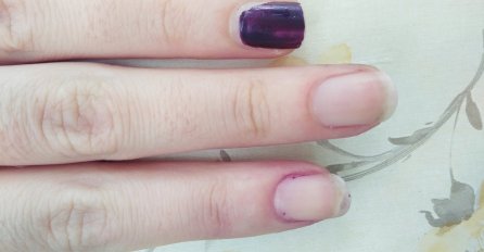 ACETON NIJE POTREBAN! Evo kako da najlakše i brzo SKINETE LAK za nokte, uz proizvode koje VEĆ IMATE!