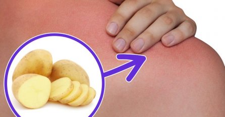 OPEKLI STE SE? Dovoljno je da narežete krumpir na kriške i slijedite ove jednostavne upute