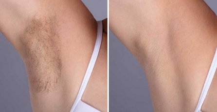 Uz ova 2 sastojka DLAČICE ispod PAZUHA više neće biti problem! Imate sve sastojke kod kuće, BIĆETE ODUŠEVLJENE REZULTATOM