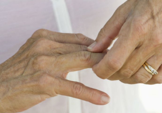 KOSTI NE VOLE OVU HRANU, ZBOG NJE JE BOL JAČI: Artritis napreduje, zglobovi se troše - LJEKARI UPOZORAVAJU