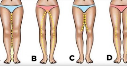 OBLIK VAŠIH NOGU OTKRIVA KAKVA STE ŽENA: Žene koje imaju ovakav oblik nogu su obično vrlo osjećajne i PRIVLAČNE SVIM MUŠKARCIMA