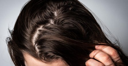 NEMOJTE PRETJERIVATI: Greška broj jedan zbog koje vam se kosa zamasti već dan nakon pranja